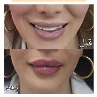 پنجاه درصد تخفیف ژل صورت