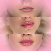 کلینیک تزریق ژل و بوتاکس آنزیم فیلر لب پزشک مطب|خدمات آرایشگری و زیبایی|کرج, گوهردشت|دیوار