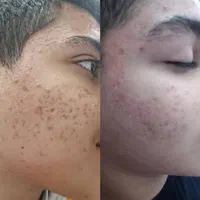 درمانگاه تخصصی ستایش پوست و زیبایی|خدمات آرایشگری و زیبایی|اهواز, کیانپارس |دیوار