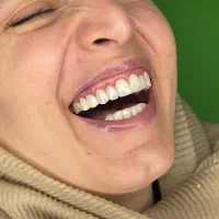 کلیه خدمات دندانپزشکی/اقساط12ماهه/بدون کارمزد|خدمات آرایشگری و زیبایی|قم, حنیف نژاد|دیوار