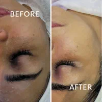 فیشیال تخصصی توسط پیراپزشک|خدمات آرایشگری و زیبایی|شیراز, پارک آزادی|دیوار