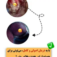 کلینیک ناباروری ، تنبلی تخمدان و پاکسازی رحم|خدمات آرایشگری و زیبایی|مشهد, بهشت|دیوار