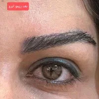 ریمووانواع تتوهای بدن،لب،وچشم ،ابرو|خدمات آرایشگری و زیبایی|رشت, حمیدیان|دیوار