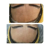 جشنواره فیشال تخصصی پوست پاکسازی + آبرسانی حرفه‌ای|خدمات آرایشگری و زیبایی|زنجان, |دیوار