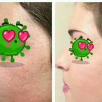 پوست خودراب ما بسپارید