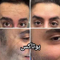 جشنواره تخفیف ویژه لیزر،ژل،بوتاکس،کلیه خدمات پزشکی