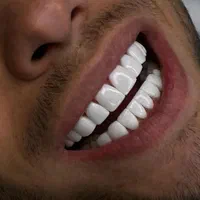 کامپوزیت دندان جشنواره تابستانه فقط تا ده روز|خدمات آرایشگری و زیبایی|کرج, گوهردشت|دیوار