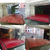 رفع آفتاب سوختگی بدون رنگ بشرط کارشناسی
