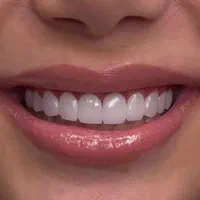 کامپوزیت دندان/ایمپلنت/کلیه امور درمانی و زیبایی|خدمات آرایشگری و زیبایی|اصفهان, کوی ولی عصر|دیوار