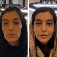 تزریق، فیلر ، بوتاکس، ژل ، آنزیم|خدمات آرایشگری و زیبایی|شیراز, سینما سعدی|دیوار