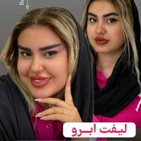 تزریق ژل بوتاکس لیفت صورت وشقیقه آنزیم مزو|خدمات آرایشگری و زیبایی|تهران, صادقیه|دیوار