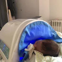 اجاره روزانه دستگاه زردی نوزاد(فتوتراپی درمنزل)|خدمات آرایشگری و زیبایی|رشت, گلسار|دیوار