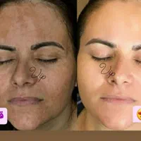 کرم سفید کننده ی عروس بندر|آرایشی، بهداشتی، درمانی|بندرعباس, |دیوار