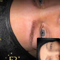 ۴۰٪تخفیف پاک‌کردن تاتو صورت میکرو ابرو تا آخر هفته