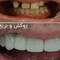 کلیه خدمات دندانپزشکی با