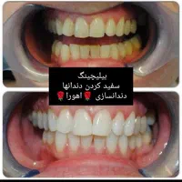 دندان ،دندان سازی ،دندان مصنوعی ،جوان پسند،اقساطی|خدمات آرایشگری و زیبایی|مشهد, شاهد (شهرک غرب)|دیوار