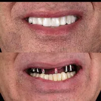 کلینیک تخصصی دندانپزشکی و ایمپلنت دکتر دانشور|خدمات آرایشگری و زیبایی|شیراز, معالی‌آباد|دیوار