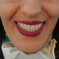 دندانسازی/دندان مصنوعی/بامجوزرسمی و۷۰سال سابقه|خدمات آرایشگری و زیبایی|مشهد, پایین خیابان|دیوار