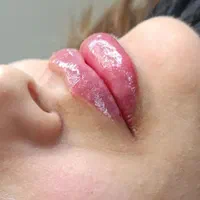 جشنواره تزریق ژل و بوتاکس مزوتراپی مزوژل|خدمات آرایشگری و زیبایی|شیراز, تحویلی|دیوار