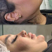 مرکزلیپوساکشن‌ و ساکشن غبغب و زاویه سازی توسط جراح|خدمات آرایشگری و زیبایی|مشهد, سناباد|دیوار