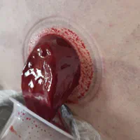 حجامت و فصد خون تخصصی با بیش از هفده سال سابقه|خدمات آرایشگری و زیبایی|سنندج, |دیوار