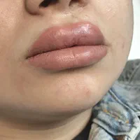 جشنواره اگزوزوم، فیلر بادی نخ،ژل،پی ارپی|خدمات آرایشگری و زیبایی|تهران, سعادت‌آباد|دیوار