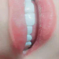 دنتال لند|خدمات آرایشگری و زیبایی|کرمانشاه, |دیوار