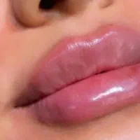 زیبایی ،ژل وبوتاکس زنان ومامایی.تخفیفات