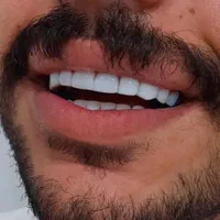 خدمات دندانسازی و دندانپزشکی|خدمات آرایشگری و زیبایی|ارومیه, |دیوار