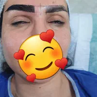 کاشت ابرو تخصصی با چندین سال تجربه کاری
