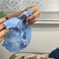 پاکسازی لیزرخالبرداری،توسط پزشک|خدمات آرایشگری و زیبایی|کارون, |دیوار