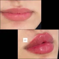 آموزش فیلر و بوتاکس صد درصد یادگیری|خدمات آموزشی|اهواز, کیانپارس |دیوار