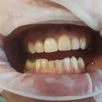 کلینیک تخصصی دندانپزشکی امین|خدمات آرایشگری و زیبایی|مشهد, چهارچشمه|دیوار