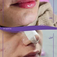 لب / ژل لب / روسی و طبیعی|خدمات آرایشگری و زیبایی|شوش, |دیوار