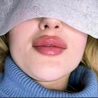 تزریق ژل بوتاکس لیفت نخ هایفو بلفاروپلاستی لیزر