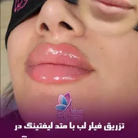 کلینیک تخصصی آوینا|خدمات آرایشگری و زیبایی|تهران, گاندی|دیوار
