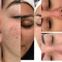 فیشیال تخصصی پوست|خدمات آرایشگری و زیبایی|سبزوار, فرهنگیان|دیوار