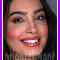 چک صیادی بلیچینگ ونیر جراحی دندان لیرینگ کامپوزیت|خدمات آرایشگری و زیبایی|تهران, تهران پارس|دیوار