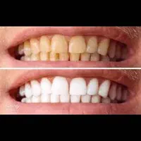 دندانپزشکی نقد و اقساط باتخفیفات بینظیر دندانپزشکی|خدمات آرایشگری و زیبایی|شیراز, قصرالدشت|دیوار