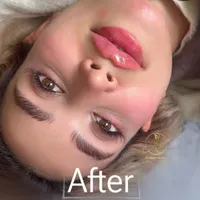 تزریق ژل و بوتاکس تخفیف بهاره ۳۹۹|خدمات آرایشگری و زیبایی|تهران, نازی‌آباد|دیوار