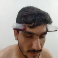 طب سنتی زالو درمانی و حجامت|خدمات آرایشگری و زیبایی|اهواز, گلستان|دیوار