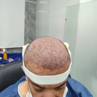 جذب تکنسین کاشت مو|استخدام درمانی، زیبایی، بهداشتی|شیراز, قدوسی غربی|دیوار