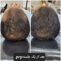 مرکز لیزر و زیبایی دکتر کیانی/ ژل بوتاکس مزو|خدمات آرایشگری و زیبایی|اهواز, کوروش|دیوار