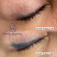 آموزش ریموو ابرو،ریمو ابرو،خط چشم،خط لب،ریمووتتو|خدمات آرایشگری و زیبایی|مشهد, احمدآباد|دیوار