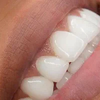 دندانپزشکی/ هدیه ویژه مراجعین جدید