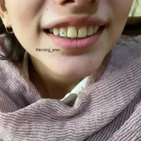 جشنواره فیلر ژل لب چال لپ کاشت نگین دندان پیرسینگ|خدمات آرایشگری و زیبایی|زنجان, |دیوار