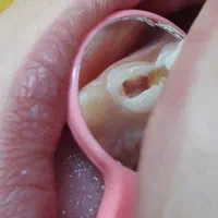 دندانپزشکی اطفال کودک‌ و نوجوان فردیس کرج|خدمات آرایشگری و زیبایی|فردیس, فردیس|دیوار