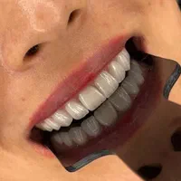 کامپوزیت/لمینت/روکش/پالیش|خدمات آرایشگری و زیبایی|تهران, طرشت|دیوار