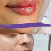 لب / ژل لب / روسی و طبیعی