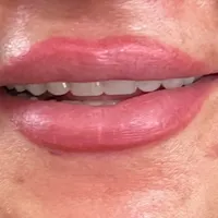 دست دندان متحرک/تعمیر دندان مصنوعی|خدمات آرایشگری و زیبایی|کرج, چهارصد دستگاه|دیوار